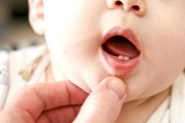 子供と乳歯